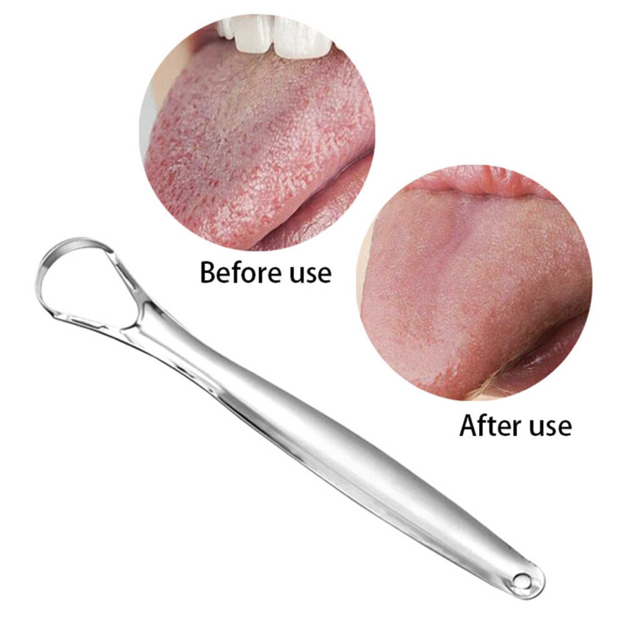 Stainless Steel Tongue Scraper Cleaner Oral Hygiene Reduce Bad Breath Metal Tool-5